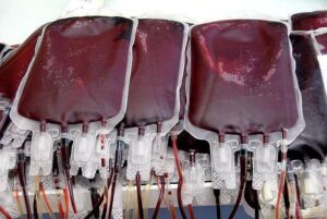 Stem Cell Donation